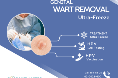 รักษาหูดหงอนไก่ ด้วยไอเย็นสำหรับบริเวณจุดซ่อนเร้น