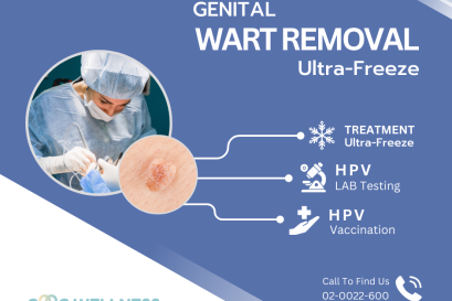 รักษาหูดหงอนไก่ ด้วยไอเย็นสำหรับบริเวณจุดซ่อนเร้น