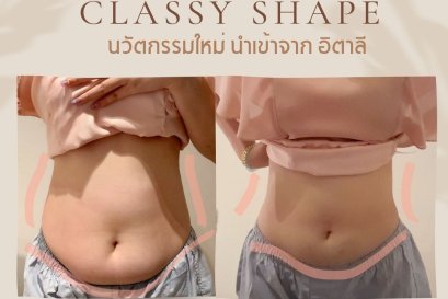 ลดไขมัน สลายเซลลูไลต์ กระชับผิว ด้วย Classy Shape จากอิตาลี ไม่เจ็บ ไม่ใช้เข็ม