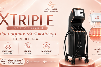 XTRIPLE Phuket ยกกระชับหน้า 3 Lines ใน 1 Shot | ณภัชชาคลินิก ภูเก็ต