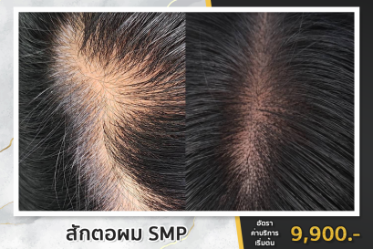 9. สักตอผม SMP