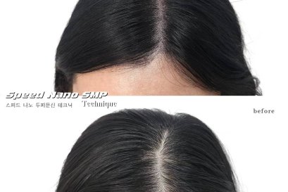 เรียนสักสกินเฮด/ดอทไรผม SMP Master Class 3 วัน