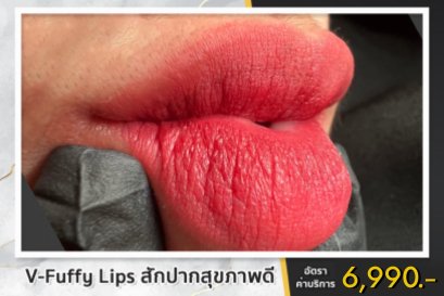 5. สักปากสุขภาพดี V-Fuffy Lips