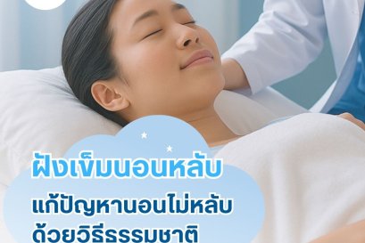 ฝังเข็มแก้นอนไม่หลับ