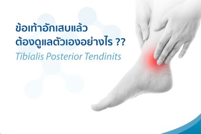 รักษาอาการ เส้นเอ็นไหล่อักเสบ