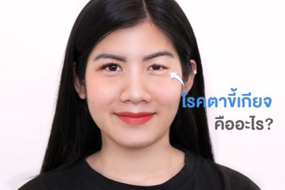 "  โรคตาขี้เกียจ  "