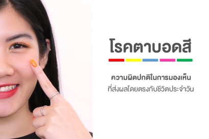 "  โรคตาบอดสี  "