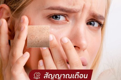 สัญญาณเตือน!! ผิวแห้ง หน้าโทรม