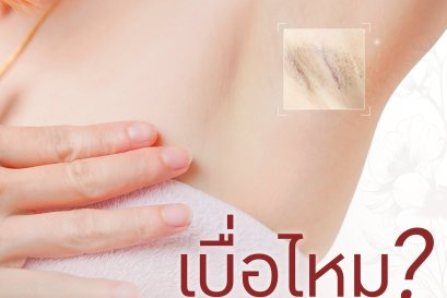 เบื่อไหม?? ผิวใต้วงแขนไม่เรียบเนียน