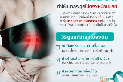 "กระดูกสันหลังเคลื่อน" สัญญาณเตือนที่ห้ามมองข้าม