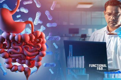 แนวทางการพัฒนางานวิจัยอาหารฟังก์ชันด้วยแบบจำลองลำไส้ tiny-TIMsg และ TIM-2 Guidelines for Advancing Functional Food Research Using Simulated Gut Models:  tiny-TIMsg and TIM-2