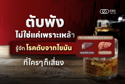 ตับพังไม่ใช่แค่เพราะดื่มเหล้า รู้จัก โรคตับจากไขมัน ที่ใครก็เสี่ยงได้ !