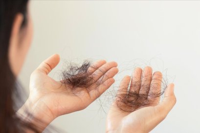 สาเหตุและวิธีรักษาผมร่วงในผู้หญิง พร้อมคำแนะนำเกี่ยวกับวิตามินที่ช่วยแก้ปัญหาผมร่วง