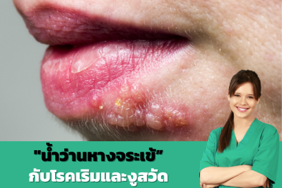 "โรคเริม" และ "โรคงูสวัด" เป็นการติดเชื้อจากไวรัสทั้งคู่ แต่แตกต่างกันในเรื่องสาเหตุและอาการ