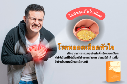 โรคหลอดเลือดหัวใจ (CHD) 