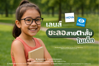 เลนส์ชะลอสายตาสั้นในเด็ก