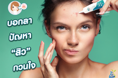 บอกลา ปัญหา “สิว” กวนใจ