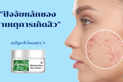 ปัจจัยหลักของ สาเหตุการเกิดสิว