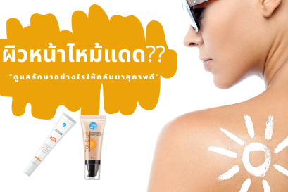 ผิวหน้าไหม้แดด?? ดูแลรักษาอย่างไรให้กลับมาสุภาพดี
