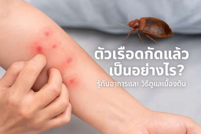 ตัวเรือด กัดแล้วเป็นอย่างไร