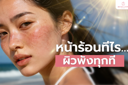 หน้าร้อนทีไรผิวพังทุกที 