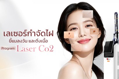 เลเซอร์กำจัดไฝ ขี้แมลงวัน และติ่งเนื้อ ด้วยโปรแกรม Co2 Laser