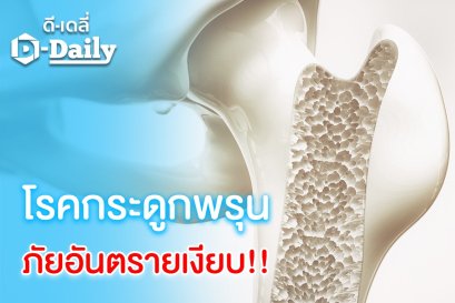 โรคกระดูกพรุนภัยอันตรายเงียบ !!