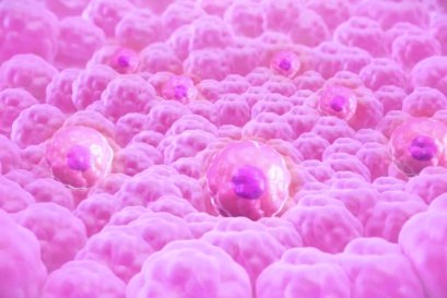 Autologous Banking ความพร้อมในการเพิ่มจำนวน เพื่อการรักษาในอนาคต