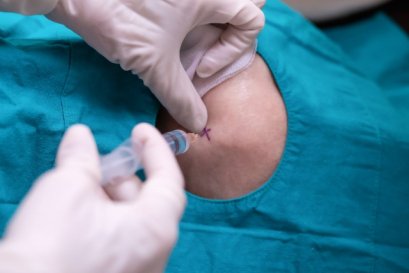 บรรเทาอาการข้อเข่าเสื่อม