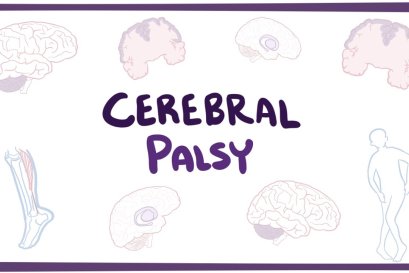 ปัญหาการสื่อความหมายของเด็กสมองใหญ่พิการ