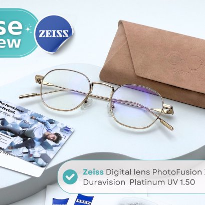 Case review  เคสคุณศิริรัตน์  โดยร้านแว่นตา Jackal x Orbit โดยนักทัศนมาตร เชียงใหม่