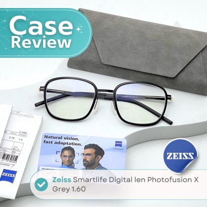 Case review  เคสคุณณัฏฐ์  โดยร้านแว่นตา Jackal x Orbit โดยนักทัศนมาตร เชียงใหม่