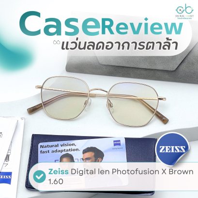 Case review  เคสคุณคุณสมพงษ์    โดยร้านแว่นตา Jackal x Orbit โดยนักทัศนมาตร เชียงใหม่(copy)