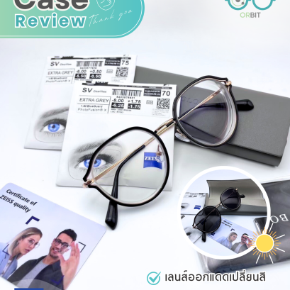 Orbit Case review  : เคสคุณพิมพ์มาดา