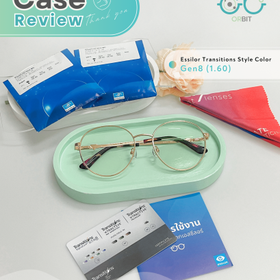 เคสรีวิวแก้ไขปัญหาสายตา คุณ แพรวรุ้ง