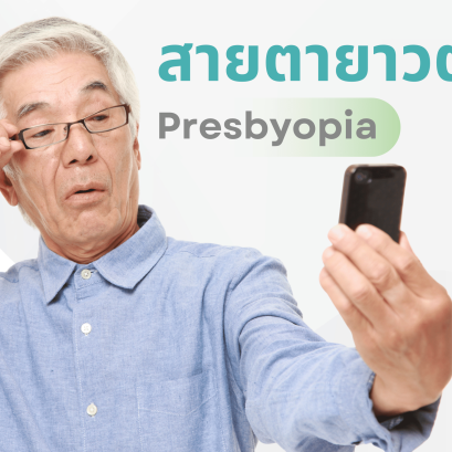 ภาวะสายตายาวตามอายุ(Presbyopia)