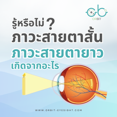 รู้หรือไม่อาการของภาวะสายตาสั้นและภาวะสายตายาวเกิดจาสาเหตุใด?