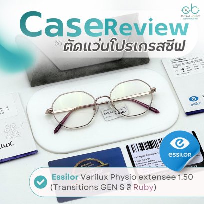 Case review  เคสคุณศรีพรรษา โดยร้านแว่นตา Jackal x Orbit โดยนักทัศนมาตร เชียงใหม่