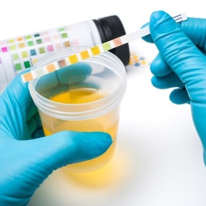 Urine Analyzer