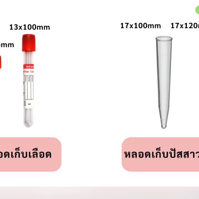 ขนาดของหลอดเก็บเลือด, หลอดเก็บปัสสาวะ