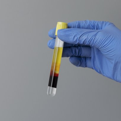 holding PRP Tube