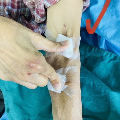 ปัญหาการดับของเส้นฟอกไต