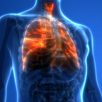 มาทำความรู้จักกับภาวะน้ำท่วมปอด (Pulmonary edema) 