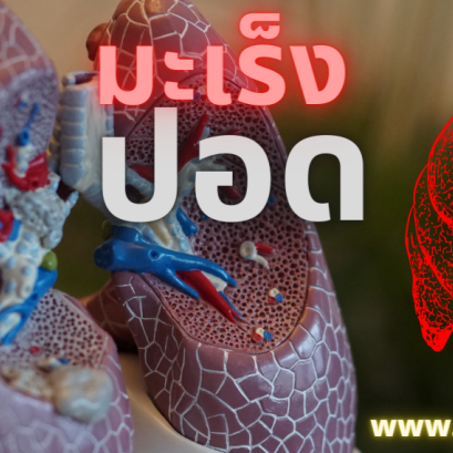 มะเร็งปอด