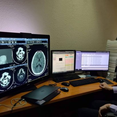 ส่งมอบอีกงาน ชุดจอคุณภาพสูงสำหรับวินิจฉัยโรคเต้านมโดยเฉพาะ Barco Coronis Uniti (MDMC-12133) 12MP diagnostic display system for PACS and breast imaging