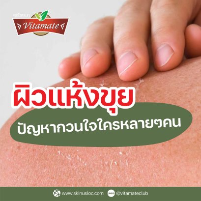 ผิวแห้งขุย ปัญหากวนใจหลายๆคน