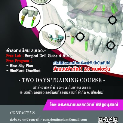 Digitally Guided Dental Implants Dr.Attawit