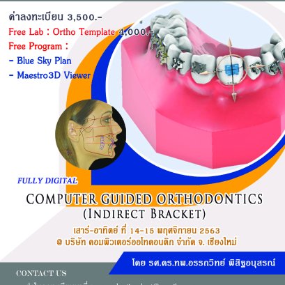 Indirect Bracket Dr.Attawit