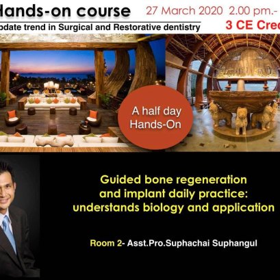 Hands On Implant