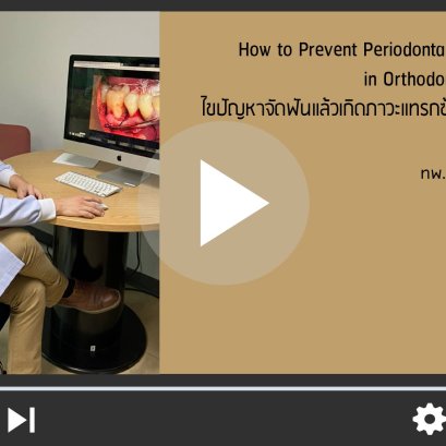 Perio-Ortho